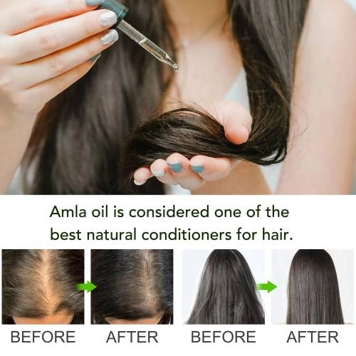 Amla Oil Aliver - 60 ml