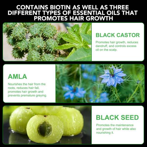 3 IN 1 Black Castor + Amla + Black Seed Oil Shampoo Aliver - 300 ml