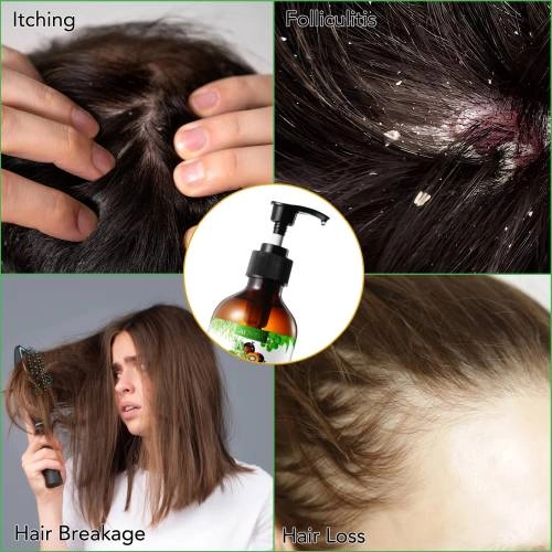 3 IN 1 Rosemary + Black Castor + Batana Oil Shampoo Aliver - 300 ml