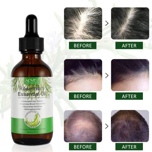 Rosemary Essential Oil Aliver - 60 ml